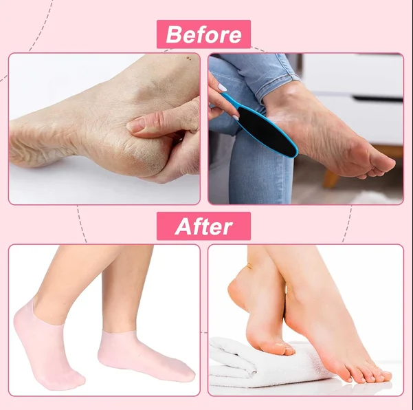 Moisturizing Foot Mask Exfoliating Silicone Socks Beach Protective Socks - 1 Pair